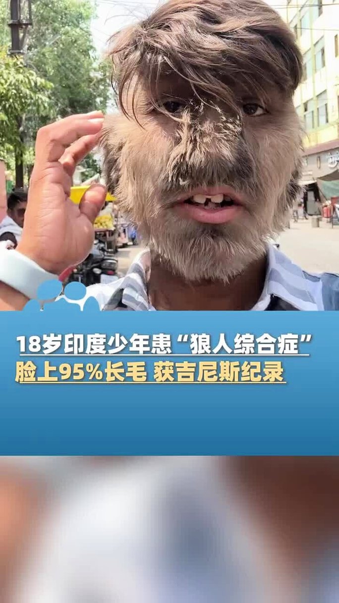 18禁免费入口的相关介绍